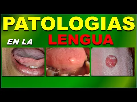 Solco in testa adulto